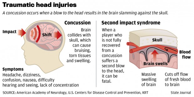 Simple Blood Test May Be Able To Diagnose Concussions For Up To Seven Days After Injury
