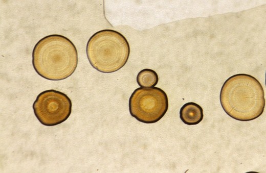 Why These 'Cool Images' May Send You Scurrying For Disinfectant!